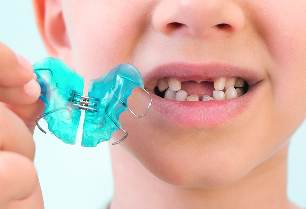 ortodoncia infantil correctora